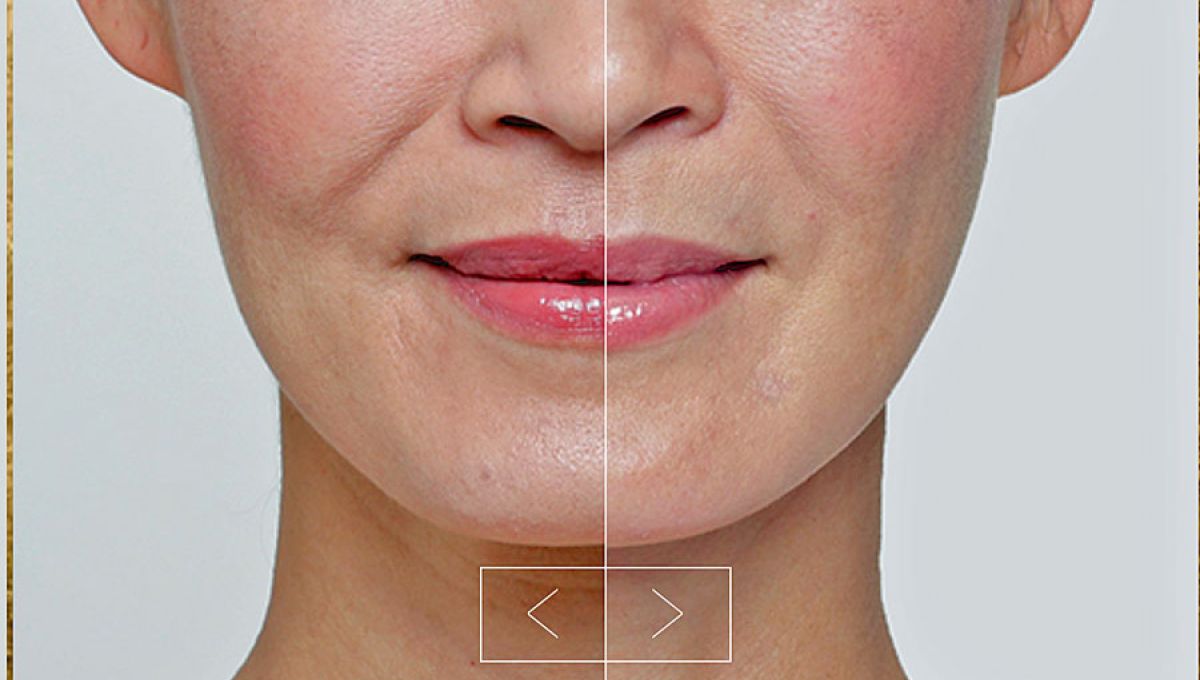 Skincare injectable treatment options.