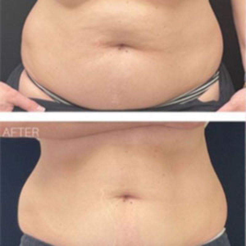 Skincare injectable treatment options.