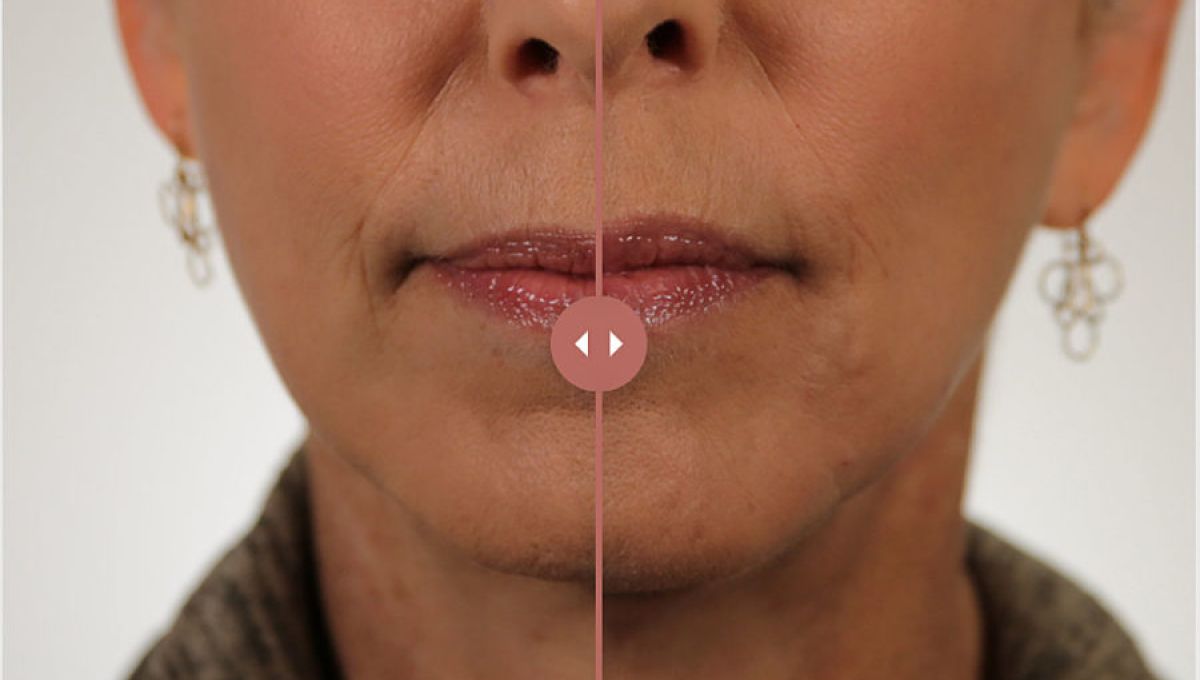 Skincare injectable treatment options.