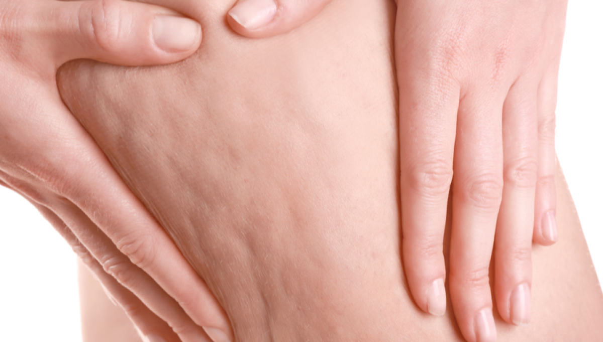 Woman with laser hair removal treatment.