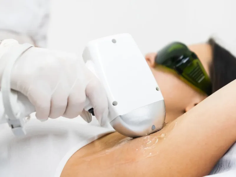 Woman with laser hair removal treatment.